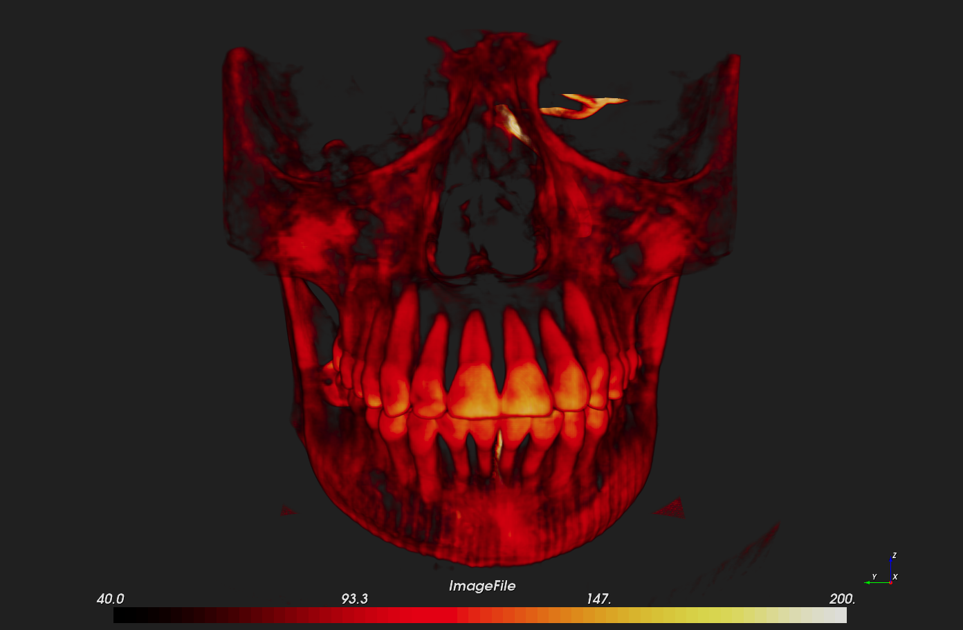 f3d